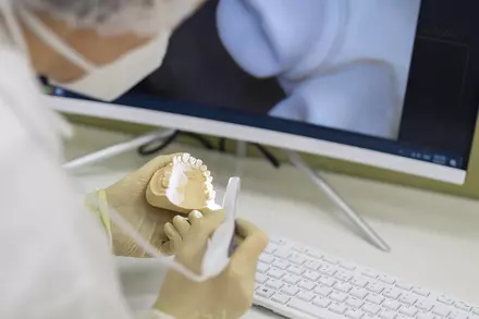 Dantų karieso gydymas