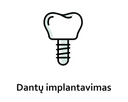 Dantu implantavimas vilniuje