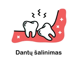 dantu salinimas rovimas odontologijos klinika city-dent