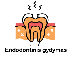 endodontinis gydymas vilniuje