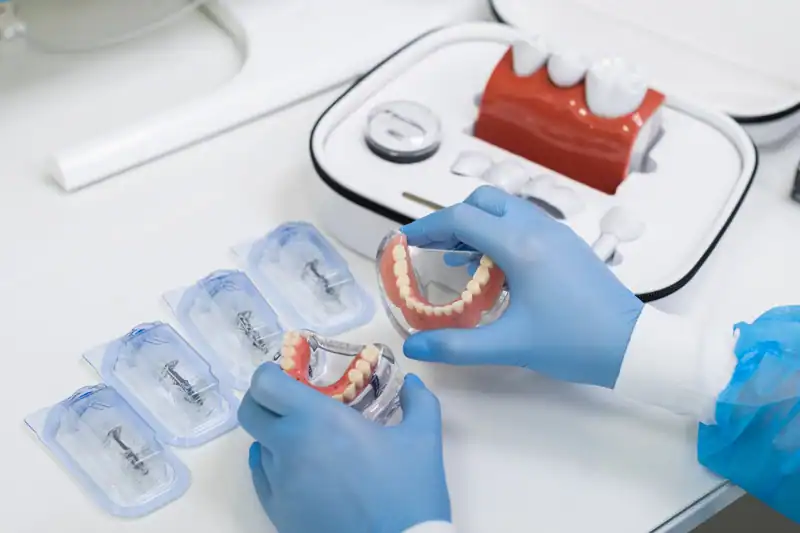 All on 4 dantu implantavimas vilnius City-Dent