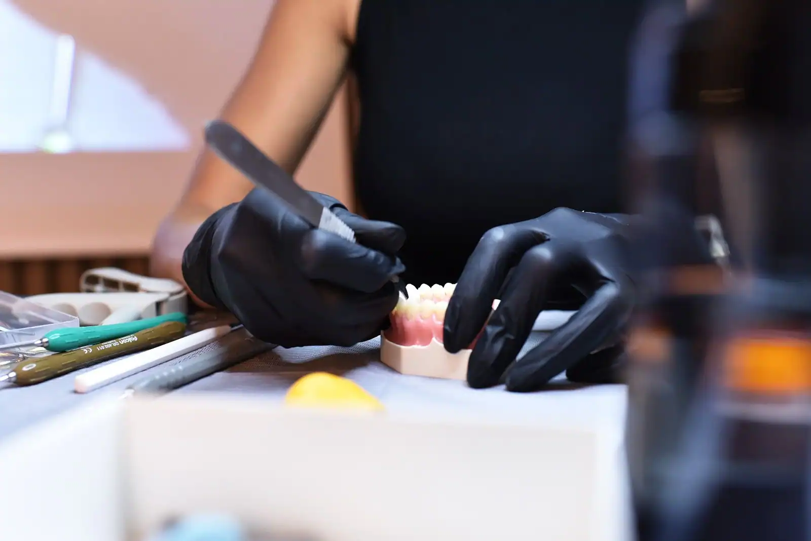 City Dent ESTETINIS PRIEKINIŲ DANTŲ PLOMBAVIMAS