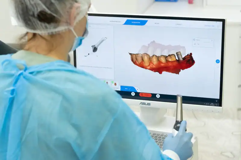 Dantų implantavimas odontologijos klinika City-Dent
